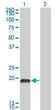 Anti-CSRP3 Antibody