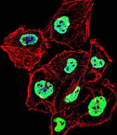 Anti-HNRNPD (N-term) Antibody