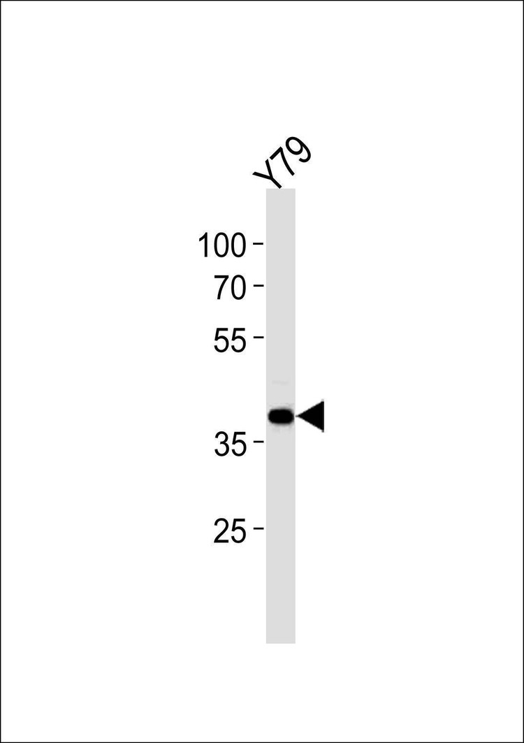 Anti-SIX3 (Center) Antibody
