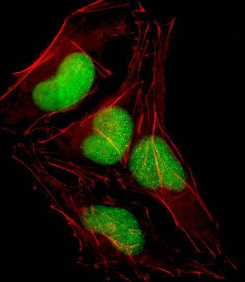 Anti-SOX18 (N-term) Antibody