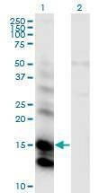 Anti-CST6 Antibody