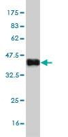 Anti-CST6 Antibody