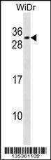 Anti-RFXANK (Center) Antibody
