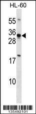 Anti-HOXB8 (C-term) Antibody