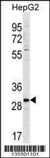 Anti-ZDHC3 (N-term) Antibody