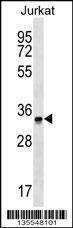Anti-OR2G6 (N-term) Antibody