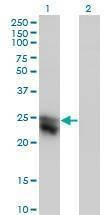 Anti-CTHRC1 Antibody
