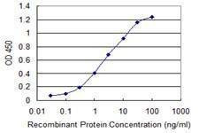 Anti-CTHRC1 Antibody