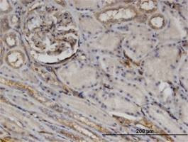 Anti-CTHRC1 Antibody