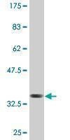 Anti-CTHRC1 Antibody