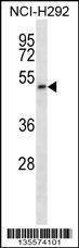 Anti-PIGT (C-term) Antibody