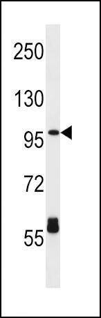 Anti-CPT1C (C-term) Antibody