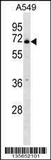 Anti-PLBD2 (Center) Antibody