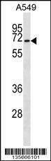 Anti-CSRNP3 (N-term) Antibody