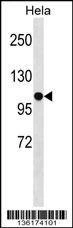 Anti-SFRS8 (N-term) Antibody
