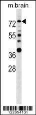 Anti-Mouse ESR1 Antibody