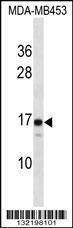 Anti-LIM2 (C-term) Antibody