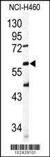 Anti-SIGLEC6 (N-term) Antibody