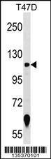 Anti-ZNF217 (N-term) Antibody