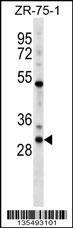 Anti-HOXD1 (N-term) Antibody