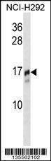Anti-TRAPPC2 (N-term) Antibody
