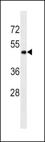 Anti-PNPLA3 (N-term) Antibody