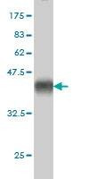 Anti-CX3CL1 Antibody