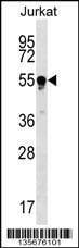 Anti-TUBB4Q (N-term) Antibody