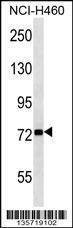 Anti-ZNF441 (N-term) Antibody