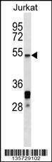 Anti-HSF5 (C-term) Antibody