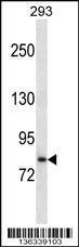 Anti-SLC39A6 (Center) Antibody