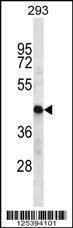Anti-HSDL2 (Center) Antibody