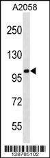 Anti-CCDC46 (N-term) Antibody