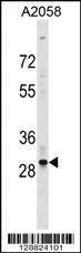 Anti-OR4F17 (N-term) Antibody