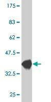 Anti-CXCL5 Antibody