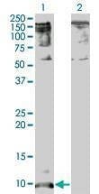 Anti-CXCL5 Antibody