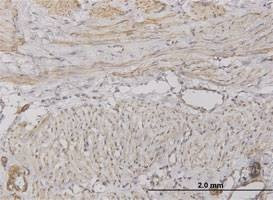 Anti-CXCL5 Antibody