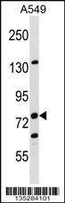 Anti-LIMA1 (N-term) Antibody