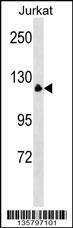 Anti-MYT1 (N-term) Antibody