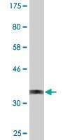 Anti-CYLC1 Antibody