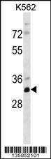 Anti-PRPS2 (Center) Antibody