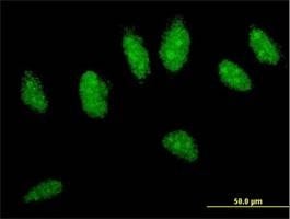 Anti-CYLD Antibody