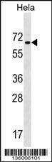 Anti-ZNF35 (Center) Antibody
