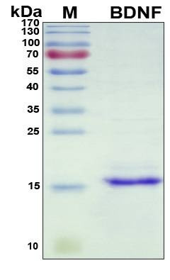 Recombinant Porcine (pig) BDNF Protein, Antigen Grade