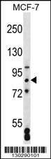 Anti-SATB2 (Center) Antibody