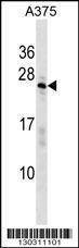 Anti-SARNP (Center) Antibody