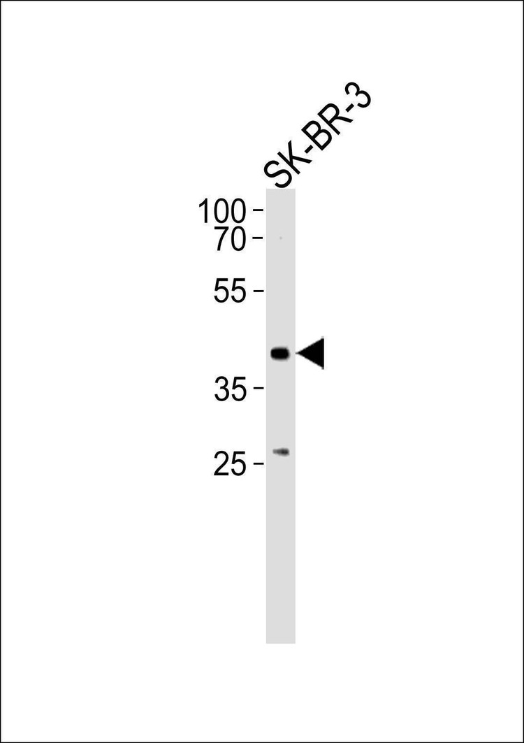 Anti-ELK3 (N-term) Antibody