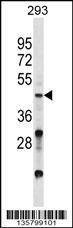 Anti-VSX2 (C-term) Antibody