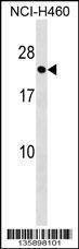 Anti-RAB41 (C-term) Antibody