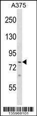 Anti-PHF21A (Center) Antibody